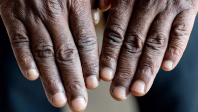 Hands look old, close up